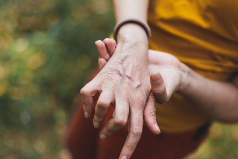 Rheumatoid Arthritis